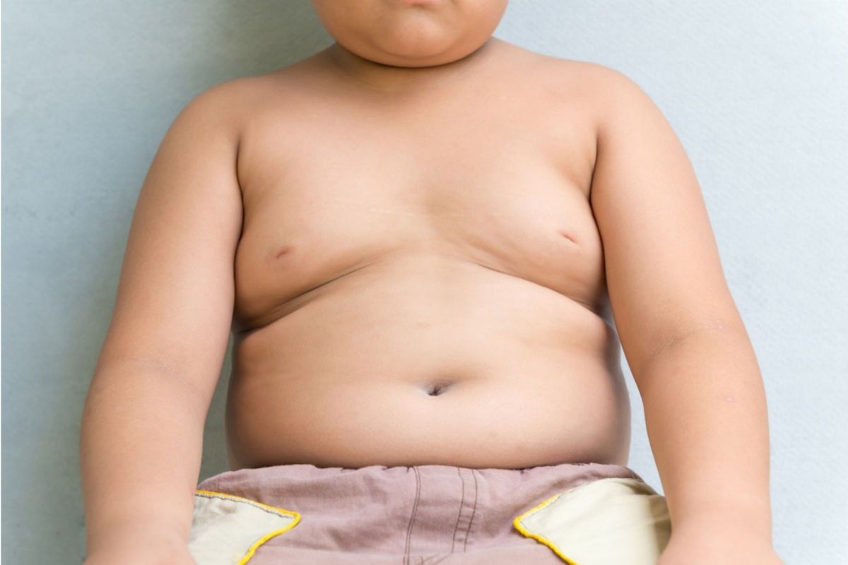 bambino obeso