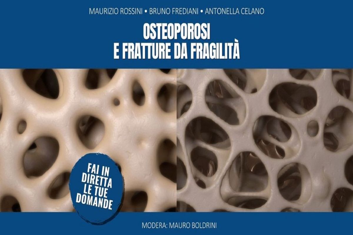 Notizie Societa Italiana Di Reumatologia